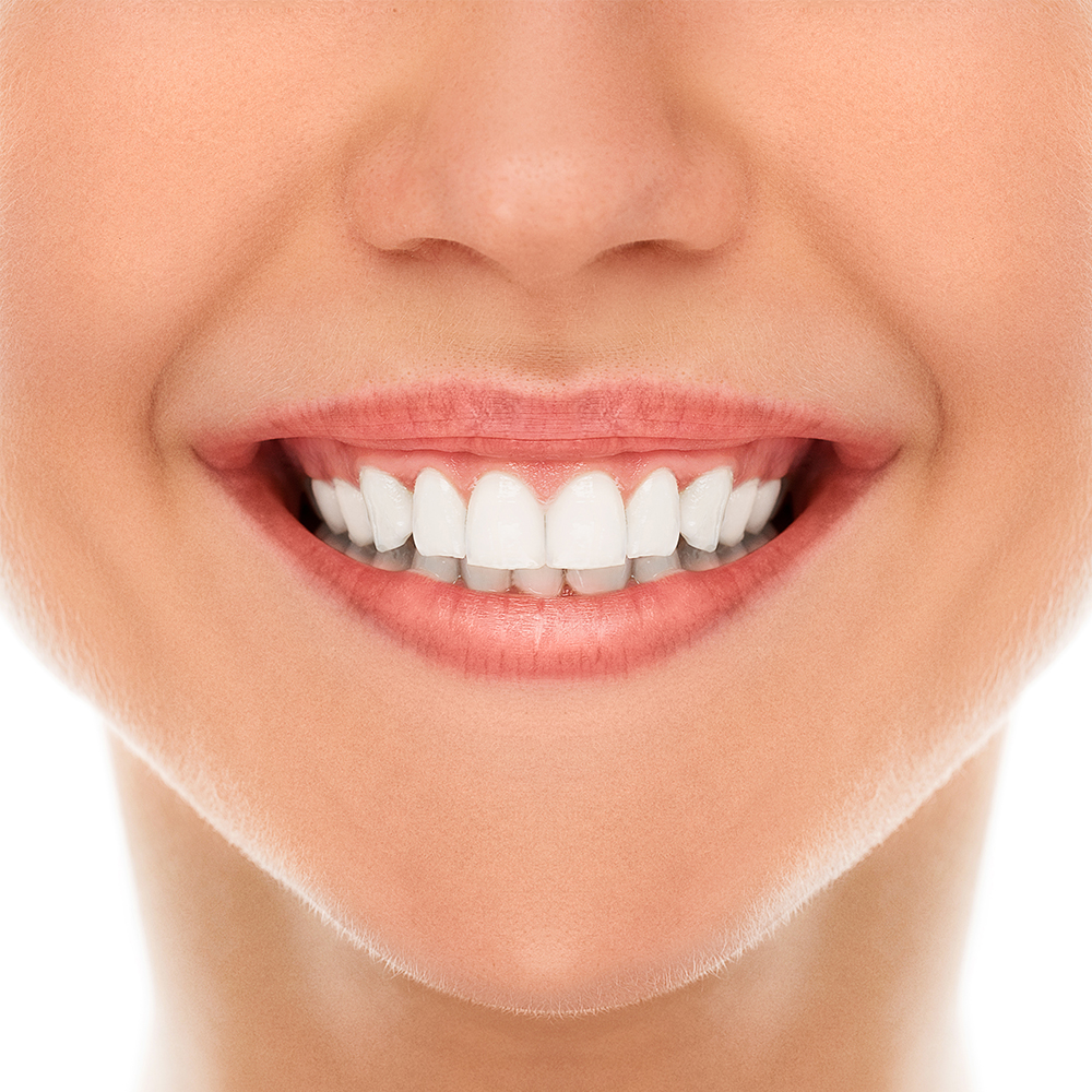 Close-up of a bright, white smile after teeth whitening